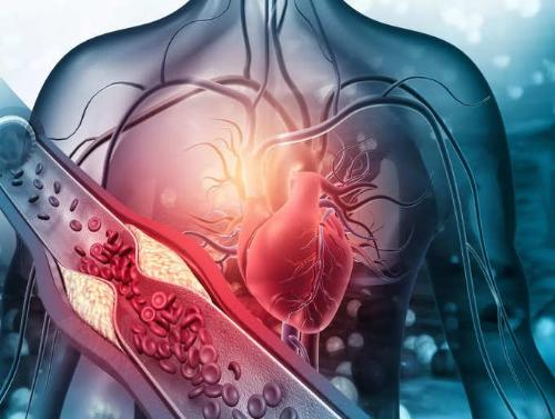 Nguy cơ mắc bệnh tim mạch khi cholesterol tăng dantri