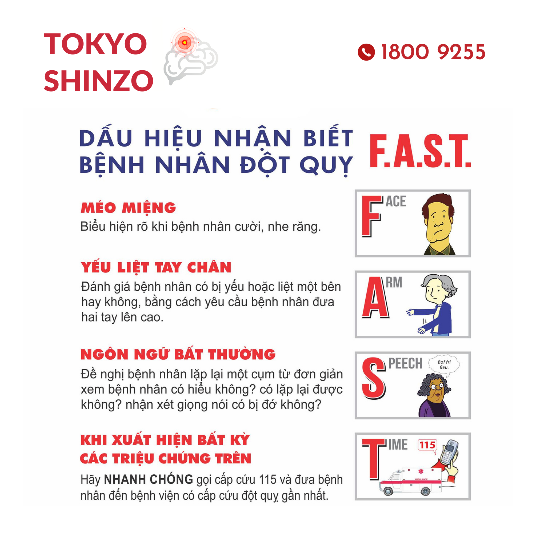 Cách để kiểm tra dấu hiệu đột quỵ thoáng qua hoặc tăng nặng