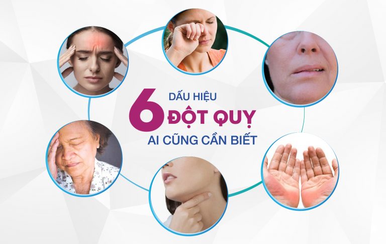 Dấu hiệu đột quỵ tim phát hiện sớm cho tương lai khỏe mạnh Triệu chứng đột quỵ tim