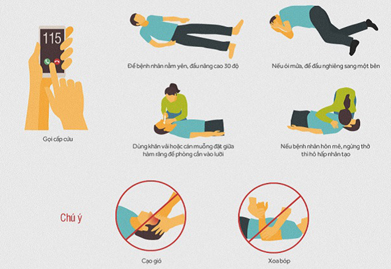 Khi phát hiện bệnh nhân đột quỵ nên làm gì?