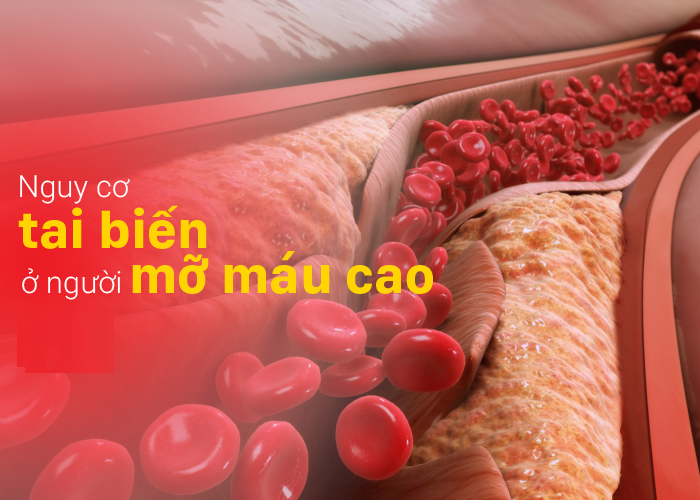 Mỡ máu cao thì sao? Làm cách nào giảm mỡ máu hiệu quả? Nguy cơ tai biến ở người mỡ máu cao