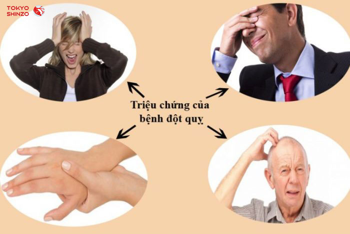 Điều trị tai biến nhẹ: Quy trình, thuốc và phòng ngừa hiệu quả triệu chứng của bệnh đột quỵ